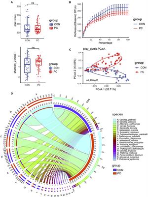 Alterations of Fungal Microbiota in Patients With Cholecystectomy